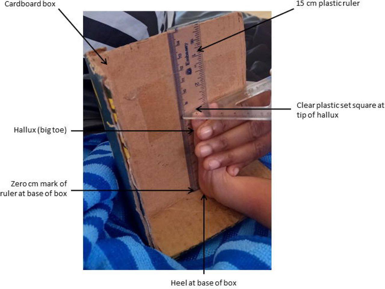 Measurement of newborn foot length. Measurements were made with a 15cm clear plastic ruler stuck to the inside of a cardboard box. The zero mark of the ruler is at the base of the box. Foot length is measured from the base of the heel to the tip of the hallux.