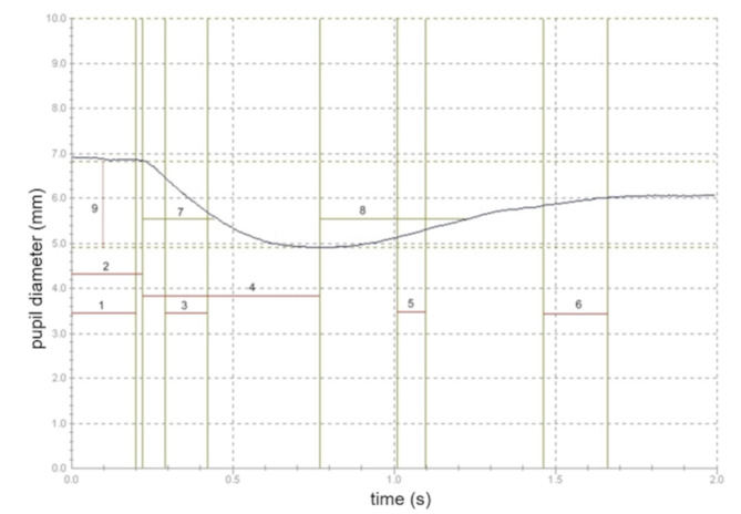 A typical pupillography curve. The following parameters are reported in this study: Initial diameter of the pupil (y-axis at time 0); Line 1: Length of stimulus (set to 200ms); Line 2: latency; Interval 3: velocity of contraction; Interval 4: constriction time; Line 9: contraction amplitude