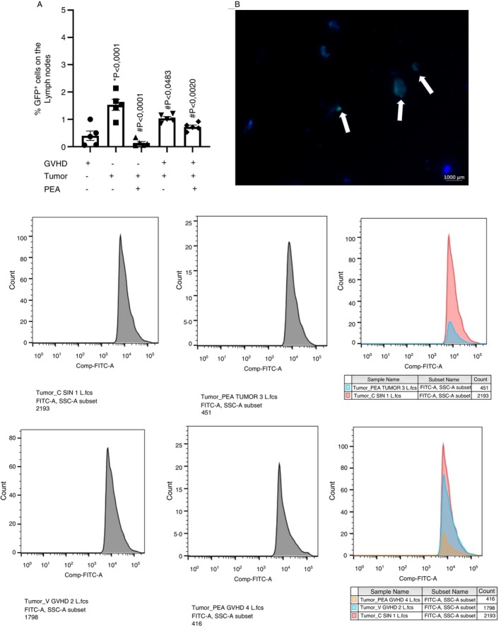 Flow Cytometry of mice lymph nodes, 7 days after disease induction and P815‐GFP+ cells transplant. GVHD was induced by bone marrow cells and splenocytes transplantation. On Day 0 of disease induction 1 × 105 P815‐GFP+ cells were injected i.v. Treatment with PEA did not alter the GVT effect. (A) Frequency of P815‐GFP+ cells were represented in dispersion graphs next to flow cytometry shards; n = 5 for all groups. *p < 0.05 compared to GVHD group alone. # p < 0.05 compared to tumour group alone. (B) Representative photo of P815‐GFP+ cells on the lymph nodes of mice. The lymph nodes were removed and the cells extracted for cytospin centrifugation and stained with DAPI for the nuclei visualisation. P815‐GFP+ cells are pointed by the arrows.