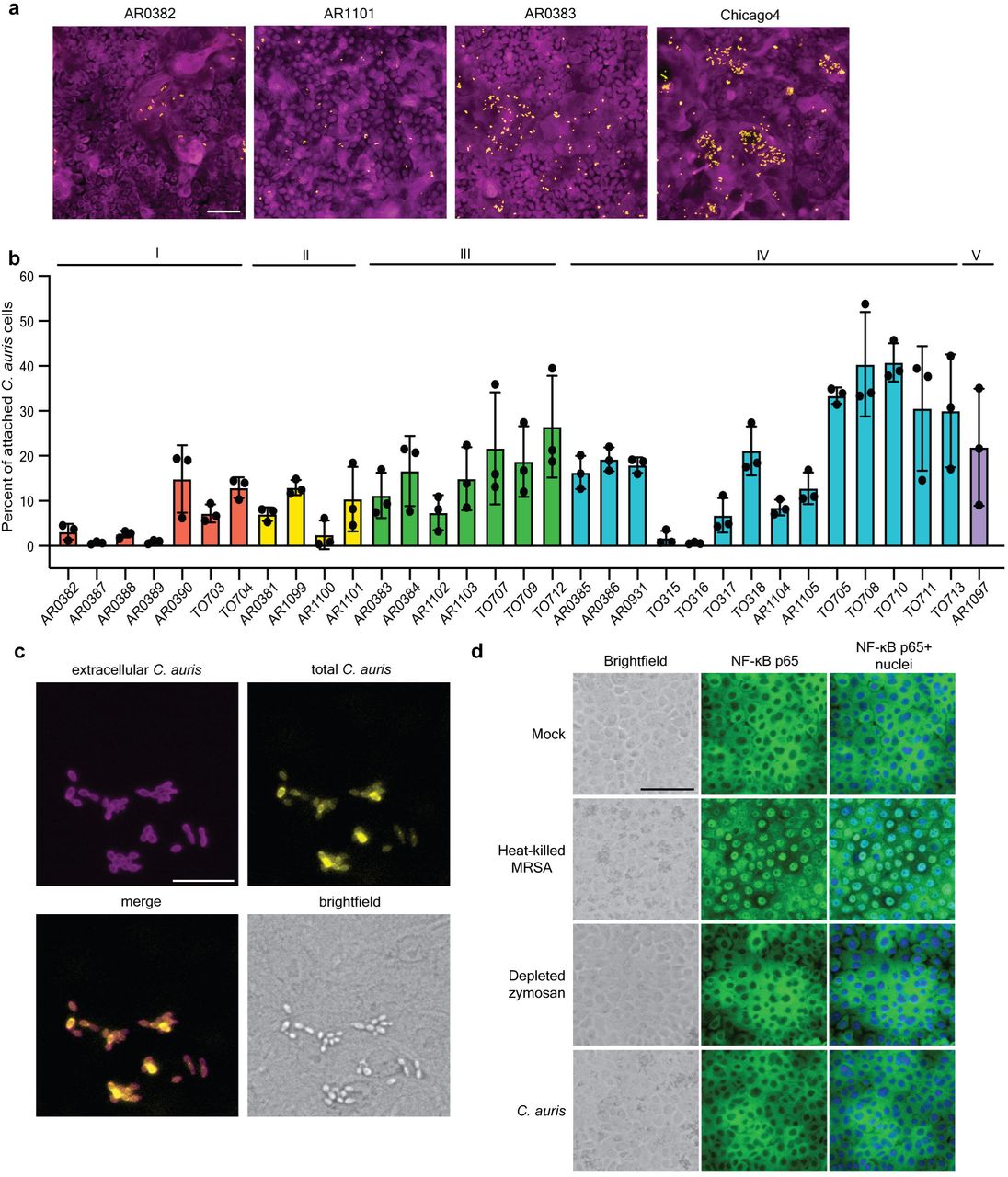 C. auris adheres to human keratinocyte cells.(A) Representative immunofluorescence images showing adherence of AR0382 (Clade I), AR1102 (Clade II), AR0383 (Clade III), and Chicago4 (Clade IV) cell to human keratinocytes. Magenta = keratinocytes, yellow = C. auris. Scale bar, 100 μm. (B) Adherence of 33 C. auris clinical isolates from five clades to keratinocytes, measured by the proportion of cells remaining attached after washing. Values represent the mean ± s. d., calculated from three biological replicates. (C) C. auris cells are not internalized. Chicago4 cells adhered to the surface of keratinocytes were detected using an FITC-conjugated anti-Candida antibody. Total C. auris cells were detected with calcofluor white stain following cell membrane permeabilization. Images are presented in pseudo color. Scale bar, 50 μm. (D) C. auris does not induce inflammatory signaling. Keratinocytes were unstimulated or stimulated with heat-killed S. aureus strain USA300, depleted zymosan, or C. auris Chicago4 cells for six hours and nuclear translocation of the NF-LB subunit p65 was detected by fluorescence microscopy. The nuclei were stained with Hoechst (blue). The middle panel shows the NF-kB staining (green) and the right panel shows the overlay. Images are presented in pseudo color. Scale bar, 100 μm. Statistical differences were assessed using one-way ANOVA (B).