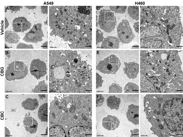 Effects of CBG and CBC treatments on the morphology and organelle structure of A549 and H460 cells. Representative transmission electron microscopy images of A549 cells (A–C) and H460 cells (D–F) treated with vehicle (A,D), 6 µM CBG (B,E), or 10 µM CBC (C,F) for 24 h. Overview images with marked areas of interest are shown in the left column, and the corresponding cellular details of these areas are shown in the images in the right column for each treatment group. Some exemplary, concise autophagosomes were marked with asterisks. In the vehicle-treated cells (A,D), numerous regularly shaped, intact mitochondria (white arrows) with adjacent rough endoplasmic reticulum (rER) membranes can be seen. In contrast, structurally altered mitochondria were observed in CBG-treated cells (B,E), including damaged mitochondrial cristae, the formation of autophagosomes (asterisks), and a mild displacement of the mitochondria-associated membranes (MAM) (white arrowheads). Similarly, after treatment with CBC (C,F), mitochondrial damage was observed, manifested in altered cristae and swollen mitochondria, but with less prominent autophagosomes and MAM displacement. The scale bars are 5 µm in the overview images and 1 µm in the detailed images.