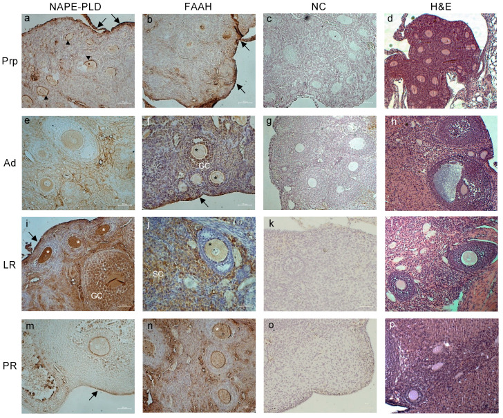 Representative images of tissue localization of NAPE-PLD and FAAH in mice ovaries during reproductive aging. Representative images of NAPE-PLD (a,e,i,m) and FAAH (b,f,j,n) immunoreactivity in prepubertal (PrP), adult (Ad), late reproductive (LR), and post-reproductive (PR) mouse ovaries. Negative controls (NC; (c,g,k,o)) and H&E staining (d,h,l,p) are also presented. Annotations and abbreviations—Arrows: ovarian surface epithelium; arrowheads: interstice granulosa cells–oocyte; asterisks: oocytes; GC: granulosa cells; SC: stroma cells. Scale bar: 50 µm. Magnification: ×200.