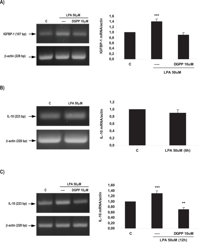 Effect of LPA on decidualization and vascularization markers in the rat uterus during the window of implantation.Uterine strips from rats pregnant on day 5 of gestation (implantation window) were incubated with LPA 50 µM for 6 and 12 h and the expression of IGFBP-1 (A) and IL-10 (B and C) was studied. In A: *** p<0,001 vs the rest; In C: *** p<0,001 vs the rest, ** p<0.01 vs C. Results are shown as means ± sem. N = 4–6 for each point. C: control.