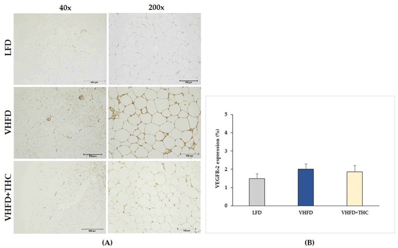 Effect of THC on VEGFR-2 expression in VHFD-induced obese mice:(A) Representative VEGFR-2 expression; left column, magnification 40×; scale bar = 500 μm; right column, magnification 200×; scale bar = 100 μm; (B) %VEGFR-2 expression. Data are presented as mean ± SEM.