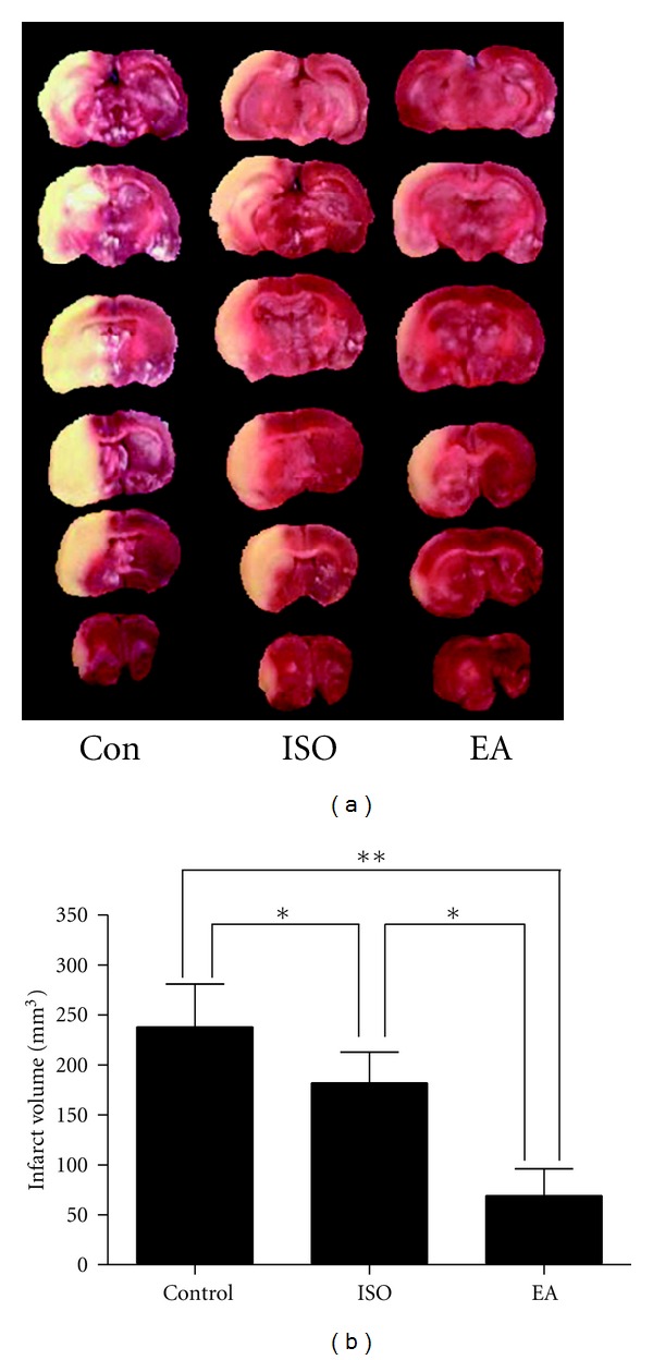 Identification (definition) of EA pretreatment. This graph shows the infarct volume of brain 24 h after MCAO for 120 min in rats. (a) Representative pictures of coronal sections of rat brain after infarction stained with 2,3,5-triphenyltetrazoliumchloride. (b) The bar graph showing the statistical analysis for infarct volumes in 3 groups. CON: control group; ISO: isoflurane pretreatment group; EA: electroacupuncture pretreatment group. (n = 10, *P < 0.05, **P < 0.01). This figure was adapted from [10].