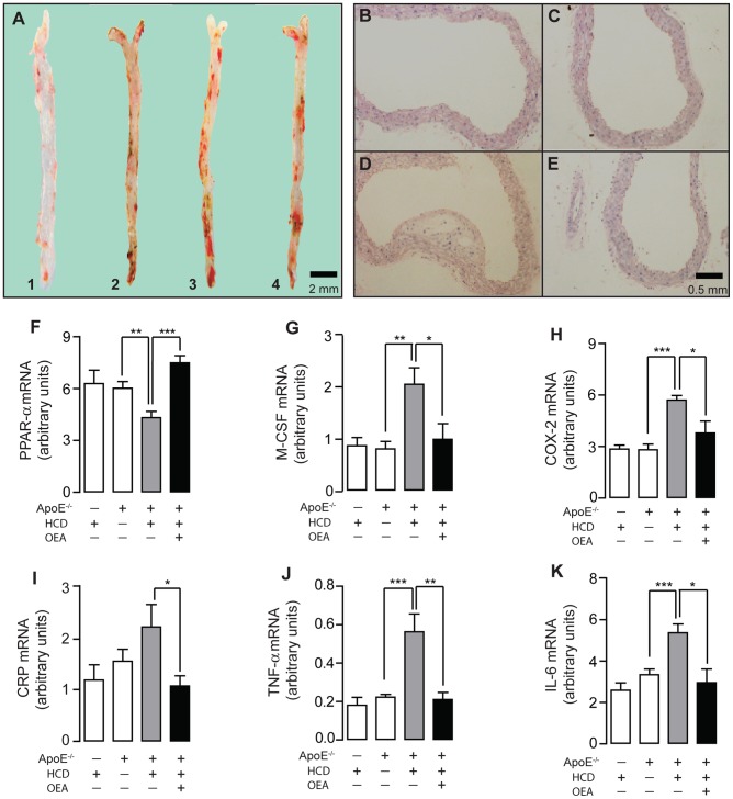 OEA reduced atherosclerotic plaque formation in ApoE−/− mice.Oil red O staining (A) and H & E staining (B–E) showed aortic atherosclerotic formation in wild-type C57mice fed with HCD (A1, B), ApoE− /− mice fed with normal diet (A2, C), ApoE− /− mice fed with HCD (A3, D), and ApoE− /−-HCD mice with OEA administration (5 mg/kg, i.p.) (A4, E). Scale bar, 2 mm or 0.5 mm. (F–K), The effect of OEA on mRNA expression levels of PPAR-α (F), M-CSF (G), COX-2 (H), CRP (I), TNF-α (J) and IL-6 (K) in aorta tissues of wt-HCD mice, ApoE− /−-ND mice and ApoE− /−-HCD mice. Vehicle, 5% PEG/5% Tween-80 in saline; OEA, 5 mg/kg/day, i.p.; * p<0.05, ** p<0.01, *** p<0.001, one-way ANOVA, n = 6–8 mice/group.