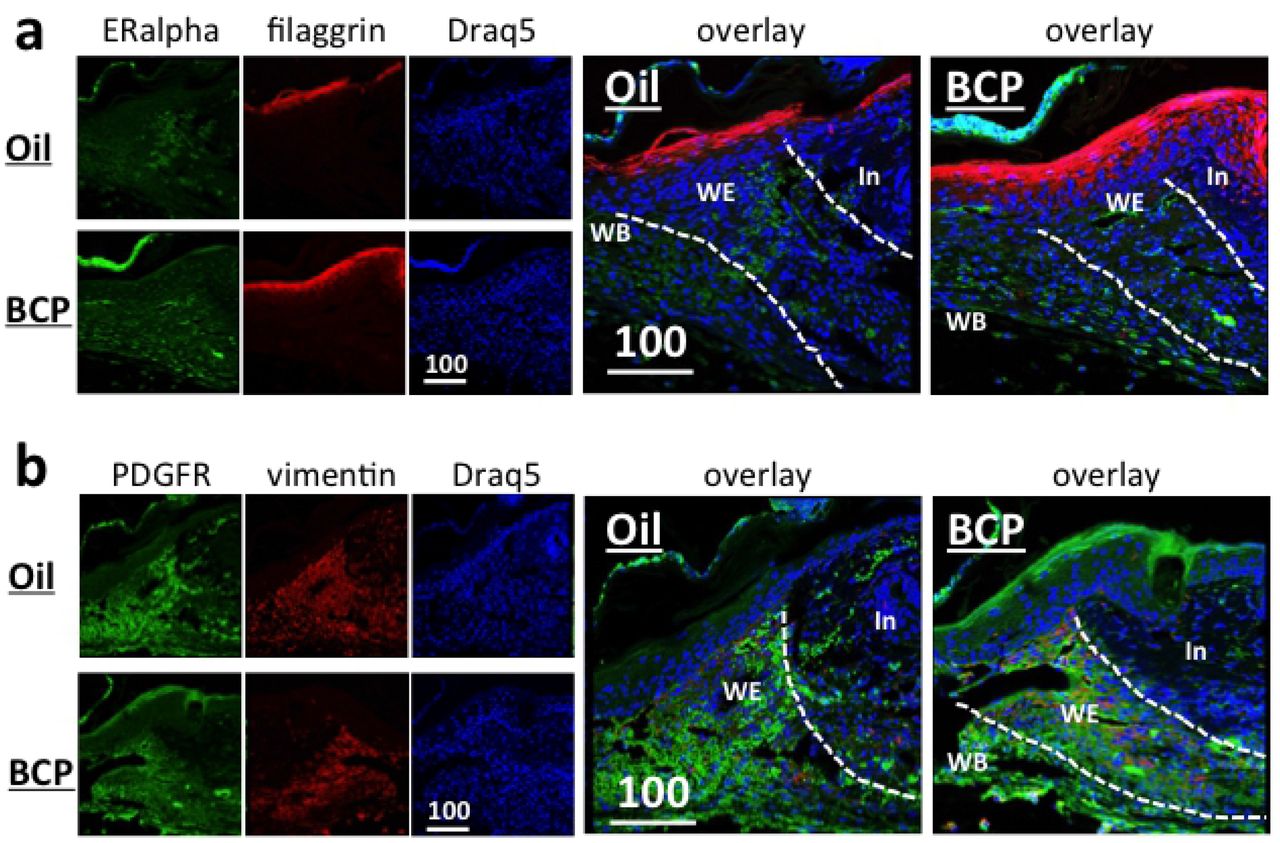 Expression of filaggrin (red) and estrogen alpha (green) (a), and PDGFR (green) and vimentin (red) (b) in the wounded area of mice.(a) View at the wound edge. In: intact area, WE: wound edge, WB: wound bed. Scale bar is in μm. Dotted lines show the boundaries between the intact area and wound edge, and the wound edge and wound bed. Filaggrin staining of BCP group was broader in width and longer in the distance from wound edge. Estrogen alpha staining did not show obvious differences between groups. (b) PDGFR expression in the epidermis was stronger in the BCP group. Both BCP and Oil group showed large area of staining of PDGFR in the wound edge (WE) and wound bed (WB). Vementin staining did not show obvious differences between BCP group and Oil group. In: intact area, WE: wound edge, WB: wound bed. Scale bars are in μum.