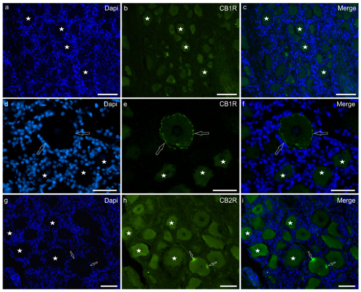 Photomicrographs of equine trigeminal ganglion cryosections showing immunoreactivity for the cannabinoid receptor type 1 (CB1R) (a–f) and type 2 (CB2R) (g–i). (a–f) Stars indicate a few sensory neurons showing faint cytoplasmic CB1R immunoreactivity of the cell body cytoplasm. The open arrows indicate a neuron in which CB1R immunoreactivity was also expressed by the cell membrane. (g–i) Stars indicate neurons expressing moderate CB2R immunoreactivity. Two open arrows indicate autofluorescent pigments which were confined to the edges of the cell. Bar: 50 µm.