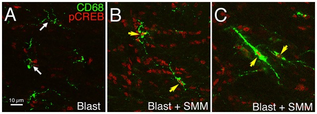 Images showing the effect of SMM-189 treatment on pCREB expression in microglia in the left internal capsule after blast. Confocal images showing immunostaining for pCREB and CD68 in a blast alone mouse (A) compared to a SMM-189-treated blast mouse (B,C) at 3 days post blast. DAPI staining (not shown) was used to identify nuclei. The nuclei of all microglia lack prominent pCREB in the blast mouse (white arrows), but all are rich in pCREB in the SMM-189-treated mouse (yellow arrows). Note that some microglia exhibit prominent CD68 expression and a rod-like morphology (C) after SMM-189 treatment, and some of these are aligned parallel to axons descending from the cerebral cortex.