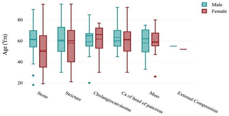 Boxplots showing the distribution of the causes of obstructive jaundice in the patients according to sex and age.