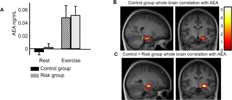 Endocannabinoid results. (A) Increase in the AEA plasma concentration after exercise compared with after rest for both groups. (B) Whole-brain correlation for the control group between individual AEA increases (after exercise minus after rest) and the fMRI contrast between exercise and rest for all associative memory trials (direct inference 1 and inference 2), showing a significant correlation in the right hippocampus (replication of Marin Bosch et al. 2021). (C) Group difference (control > risk) for whole-brain correlations with AEA, showing the implication of the right medial temporal cortex (at the superior limit of the hippocampal formation).