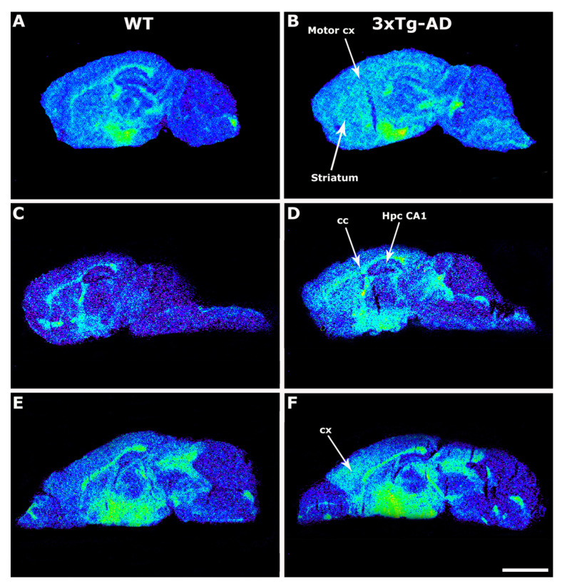 Representative autoradiograms of WT (A,C,E) and 3xTg-AD (B,D,F) mice in sagittal sections that show [35S]GTPγS stimulated by LPA (10−5 M). The [35S]GTPγS binding induced by LPA was increased in transgenic mice at striatum, motor cortex, corpus callosum, and hippocampal CA1 area. Scale bar = 3 mm. cc: corpus callosum, Hpc CA1: hippocampus CA1, motor cx: motor cortex, cx: cortex.