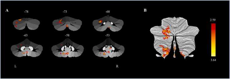 Fig. 3