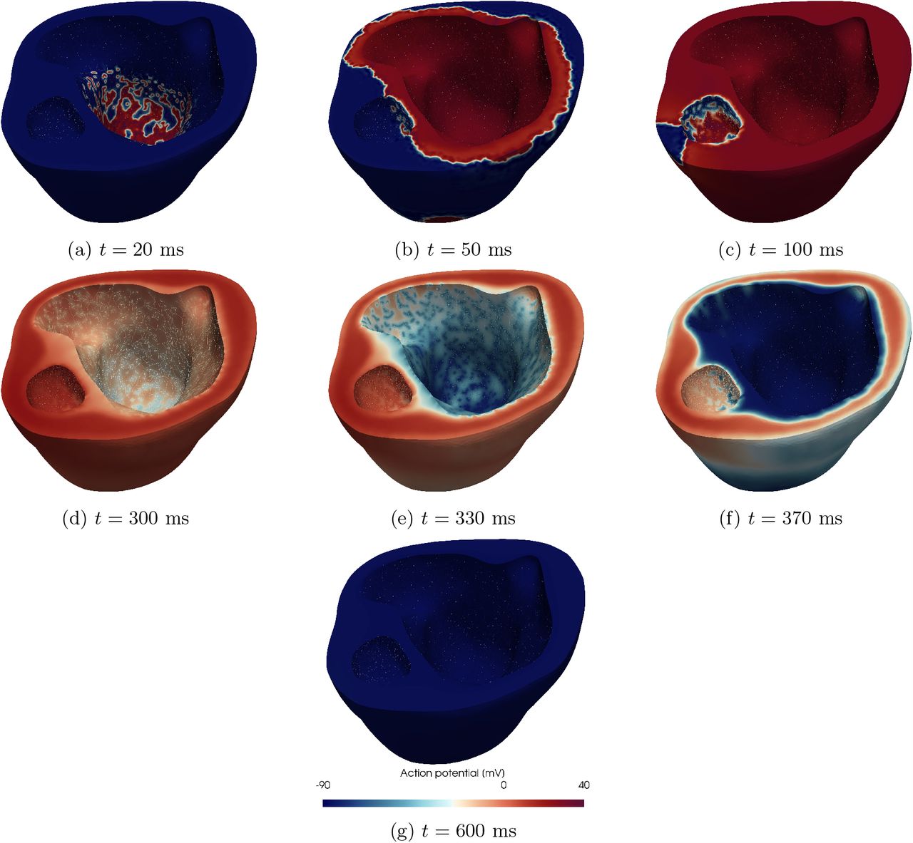 Physics-based electrophysiological modeling. Spatio-temporal membrane action potential evolution for one electrophysiology simulation in the dataset performed on the HLHS pediatric patient.