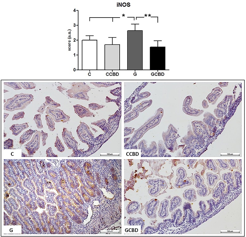 Immunohistochemistry score for iNOS expression and the histological transversal slides stained by immunohistochemistry. Data are reported as means±SD. Magnification 200×, bar=100 μm. C: control; CCBD: control+cannabidiol; G: gastroschisis; GCBD: gastroschisis+cannabidiol. *P<0.05; **P<0.005 (Kruskal Wallis).
