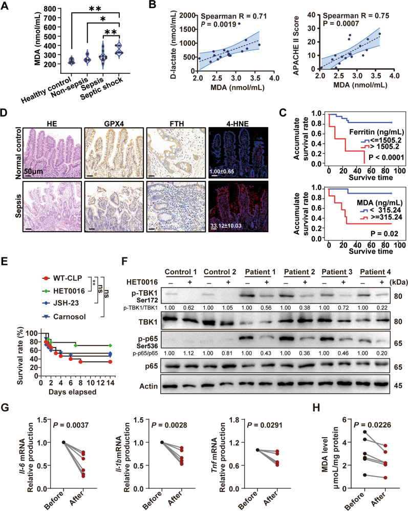 HET0016 as a lipid peroxidation inhibition protects against sepsis.A Levels of plasma MDA from healthy control or patients. B Spearman correlation analysis for plasma MDA and D-lactate or APACHE II score in all patients (n = 28). C Kaplan–Meier analysis according to a cutoff value calculated from ROC analysis. D Representative histopathological section images, immunohistochemical or fluorescent images in the intestinal tissues of patients with sepsis. The scale bar represents 50 μm. The quantified fluorescence intensity of 4-HNE was shown in the lower left corner. E Survival analysis of the indicated mice in CLP-induced sepsis with or without treatment of 10 mg/kg HET0016, 20 mg/kg JSH-23, or 10 mg/kg Carnosol at 2 h before CLP and 12, 24, 48, and 72 h after CLP (n = 15 per group). F Immunoblot analysis of p-TBK1, TBK1, p-P65, and P65 in PBMCs from patients with sepsis or healthy control, supplemented with or without HET0016 (5 μM) for 24 h (n = 4 per group). G qPCR analysis of Il-6, Il-1b, and Tnf mRNA in PBMCs from patients with sepsis or healthy control, supplemented with or without HET0016 (5 μM) for 24 h (n = 6 per group). H Production of MDA in PBMCs from patients with sepsis supplemented with or without HET0016 (5 μM) for 24 h (n = 6 per group). Data are shown as mean ± SD, and analysis by one-way ANOVA test. Data in (G, H) are analyzed by paired Student’s t-test. PBMCs peripheral blood mononuclear cells, MODS multiple organ dysfunction syndromes, MDA malondialdehyde, FTH ferritin heavy chain, GPX4 glutathione peroxidase 4, 4-HNE 4-hydroxynonenal. *P < 0.05, **P < 0.005, ***P < 0.0005, ****P < 0.0001.