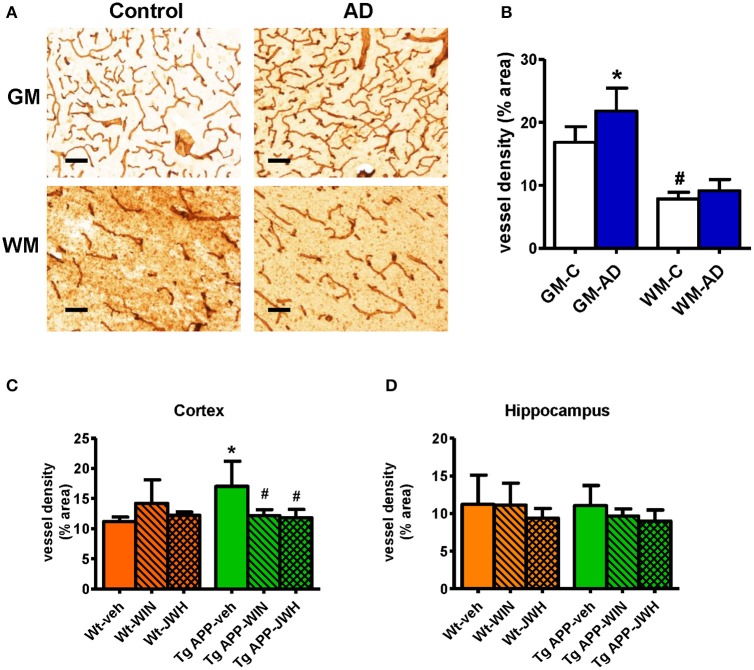 Vessel density is altered in AD compared to controls. (A) Representative collagen IV immunostaining of cortical vessels in human controls (n = 5) and AD patients (n = 6). Scale bar, 100 μm. GM, gray matter; WM, white matter. (B) Collagen IV positive vessels are significantly increased in gray matter. Results are mean ± SD (n = 5–6) and they are expressed as percentage of area occupied by vessels. *p < 0.05 versus controls, #p < 0.05 versus gray matter vessel density (Student's t-test). (C) Tg APP vehicle treated mice showed increased collagen IV vessel density in cortex vs. wild type (Wt) vehicle treated mice. Cannabinoid agonists normalized vessel density of Tg APP mice. Results are mean ± SD (n = 7–8) *p < 0.05 vs. controls (Wt-veh), #p < 0.05 vs. Tg APP-veh (Kruskal-Wallis, followed by Dunn's test). (D) No changes in vessel density were found in hippocampus due to genotype and/or drug treatment.