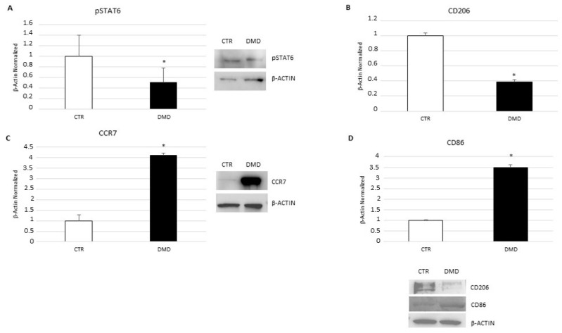 pSTAT6 (A), CD206 (B), CCR7 (C), and CD86 (D) protein expression levels in CTR macrophages and DMD-associated macrophages evaluated by Western blot technique, starting from 15 μg of total lysates. The most representative images are displayed. The protein bands were detected through Image Lab. Ink software “BIORAD”, and the intensity ratios of immunoblots compared to CTR, taken as 1, were quantified after normalizing with respective controls. The relative quantification for these proteins, normalized for the housekeeping protein β-actin, is represented in the histogram as the mean ± SD. Students’ t-test has been used for statistical analysis. *, p ≤ 0.05 compared to NT (p-values: (A) 0.0003; (B) 0.0012; (C) 0.0069; (D) 0.0521).