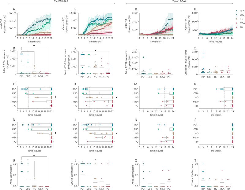 TauK18- and TauK19-SAA analyses at ankle and cervical sites in disease sub-groups.Kinetic curves of TauK18 and TauK19 seeding activity in the ankle (A, K) and cervical (F, P) sites, respectively. Each dot represents the mean (±SE) of ThT fluorescence intensity of all samples tested per group against time. The dotted line indicates the selected threshold at 10.000 arbitrary units (AU). B, G, L, Q Scatter plot of final ThT fluorescence intensities: dots represent the mean values of the final ThT fluorescence intensity for individual patients and bars the mean of the group. C, H, M, R Box and Whisker Plot showing the Lag time defined as the reaction time required to pass the threshold of 10.000 AU. The dotted line shows the selected time points (7 h for TauK18 or 18 h for TauK19) to define the positive and negative subjects. D, I, N, S Box and Whisker Plot showing the T50 defined as the reaction time required to reach 50% of the maximum fluorescence detected. E, J, O, T Seeding score defined as the number of replicates out of three that cross the threshold of 10.000 AU at 7 h. Each dot represents a patient and bars the mean of the group.