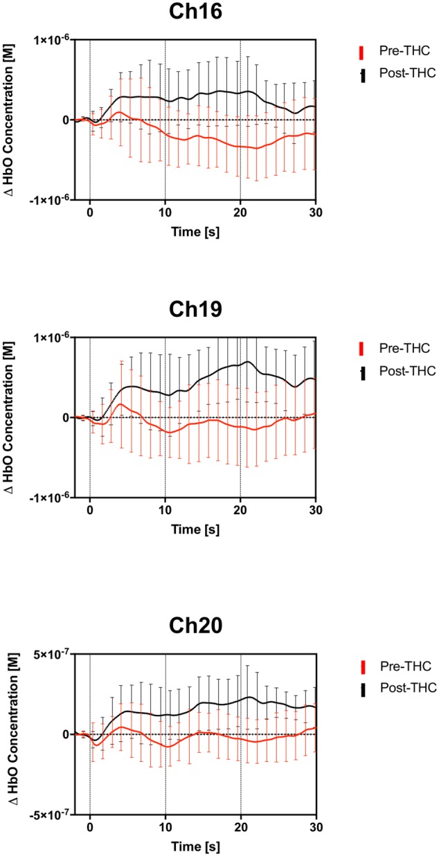 Group averaged (n = 13) time course of HbO concentration during the 2-back working memory blocks, from 0 to 30 s. Average time course and standard errors of HbO changes are shown in red for pre-THC, and black for post-THC. Error bars represent standard deviations.