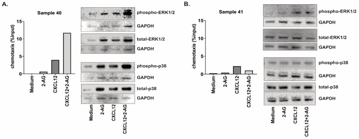 Signaling pathways activation in primary CLL samples. CLL cells from (A) Sample 40 and (B) Sample 41 were incubated for 2 min with CXCL12 (200 ng/mL) or 2-AG (100 nM) or the combination, and the activation of the signaling pathways ERK1/2 and p38 was assessed by Western blotting. The bar graphs represent the chemotaxis data for the two samples, towards medium, 2-AG (100 nM), CXCL12 (200 ng/mL) or the combination, shown as % input cells after 4 h chemotaxis. Original blot see Supplementary File S1.