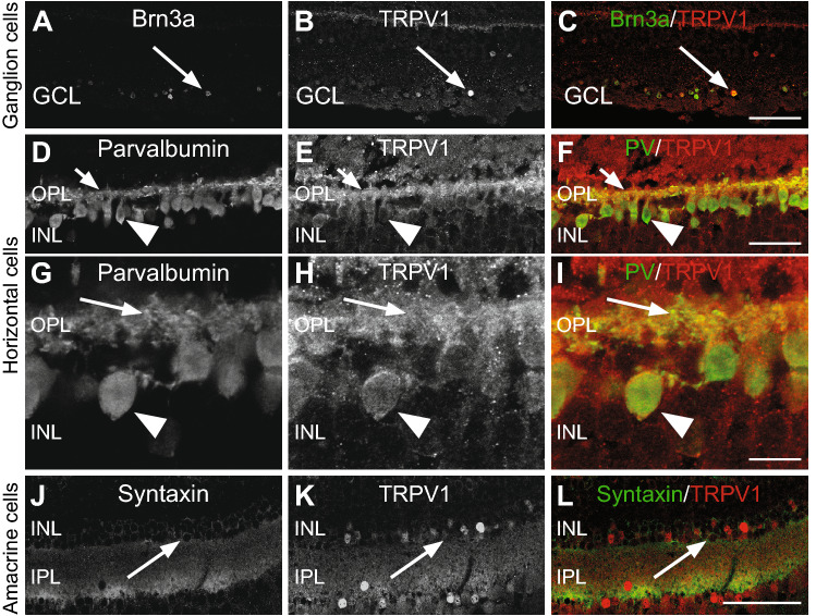 Double-label immunofluorescence illustrating immunolabeling of TRPV1 in ganglion cells, horizontal cells, and amacrine cells. (A-C) The antibody against Brn3a labels the nucleus of ganglion cells in the monkey retina, and these cells were strongly TRPV1 immunoreactive. Arrows indicate Brn3a-positive ganglion cells that are TRPV1 immunoreactive. Each protein expression is presented alone in grayscale: Brn3a (A) and TRPV1 (B); then, the two are presented merged (C), Brn3a in green and TRPV1 in red). (D-I) TRPV1 is expressed in horizontal cell synaptic terminals (arrows in OPL) and cell bodies (arrowheads in the INL). Each expression is presented alone in grayscale: PV (D,G), TRPV1 (E,H); then, the two are presented merged (F,J). (J–L) Arrows show the expression of TRPV1 in the amacrine cell bodies (INL). Each expression is presented alone in grayscale: syntaxin-positive amacrine cells (J) and TRPV1 (K); then, the two are presented merged (L). INL inner nuclear layer, IPL inner plexiform layer, OPL outer plexiform layer, GCL ganglion cell layer. Scale = 75 μm for (A–C) and (J–L), 30 μm for (D–F) and 10 μm for (G–I).