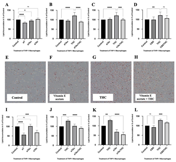Lipid accumulation in THP-1 macrophages. Cells were treated as indicated for 24 h (αT, αTAr, αTAn (50 μM); THC, CBD (6 μM)). (A–D) Staining was performed with Oil Red O, extraction with isopropanol, and absorbance was measured at OD 500 nm. An inhibitory effect was observed in THP-1 macrophages after treatment with αT, αTAr, and αTAn. (B) Stronger lipid accumulation was observed with THC, which was significantly inhibited with co-treatment with αTAn. (C) Significant inhibitory effects of αTAr were observed after THC co-treatment. (D). Stronger staining was observed with THC, which was non-significantly inhibited by co-treatment with CBD. (E–H) Staining was performed with Oil Red O in THP-1 macrophages and analyzed by light microscopy. THC induced more lipid droplets inside macrophages, and vitamin E acetate showed an inhibitory effect on lipid accumulation. 10× magnification. (I–L). Staining with Nile Red, extraction with isopropanol, and measurement by FACS at ex561/em610 nm. (E) A weak inhibitory effect was observed in THP-1 macrophages treated with αT, αTAr, and αTAn. (F) Stronger staining was induced by THC, which was significantly inhibited with co-treatment with αTAn. (G) Significant inhibitory effects were observed after αTAr and THC co-treatment, and αTAr had slightly stronger inhibitory effects than αTAn. (H) Stronger staining was observed with THC, which was significantly inhibited by co-treatment with CBD. (mean ± SEM, n = 6 for THC, CBD, αT, αTAr, αTAn, * p < 0.05, ** p < 0.005, *** p < 0.0005, **** p < 0.0001 relative to untreated control set to 100%; ns: non-significant).