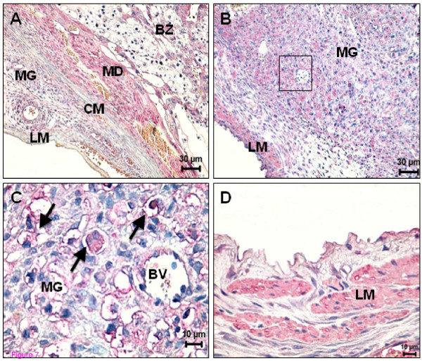 Spatial distribution of CB1 and TRPV1 in the uterus on day 16 and 19 of pregnancy. (A) On day 16, decidual and trophoblast cells from the basal zone are positive for CB1. Note the lack of expression in circular and longitudinal muscle layer; (B) In the metrial gland, the expression of TRPV1 at day 19 is mainly localized in uNK cells and in longitudinal muscle layer. (C) High power of the square depicted in (B). Expression of TRPV1 is particularly evident in uNK cells (arrows). (D) High power showing an intense positive signal for TRPV1 in the longitudinal muscle layer. BV - Blood vessel; BZ - Basal zone; CM- Circular muscle layer; LM - Longitudinal muscle layer; MD - Mesometrial decidua; MG - Metrial gland.
