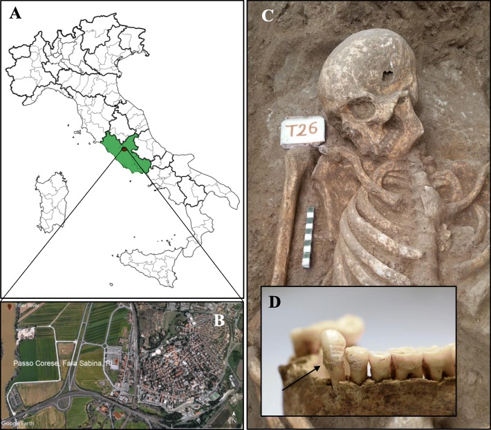 Location of Passo Corese (Fara Sabina, Latium) and inhumation of the burial 26. Map of Italy with the geographical location of the studied site (a and b, image from Google Earth); representative image of human skeletal remains (c) and detail of the relative mandibular dental calculus (d)