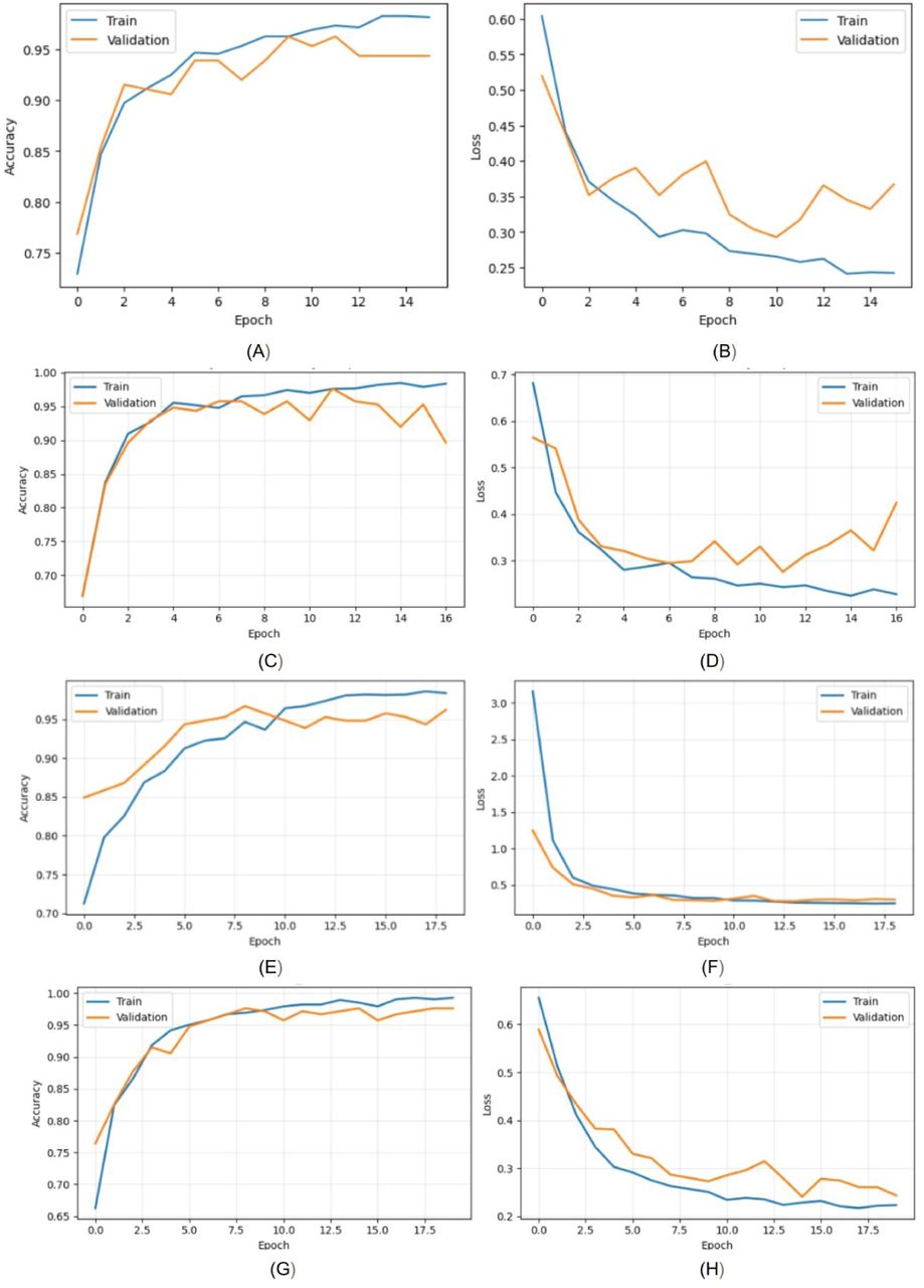 Accuracy and loss curves for trained models - (A–B) MobileViT-S, (C–D) ConvNeXt-Tiny, (E–F) EfficientNetV2-S, and (G–H) ResNeXt-50 (32×4d). Graphs (A, C, E, G) show training and validation accuracy; Graphs (B, D, F, H) show corresponding loss curves.