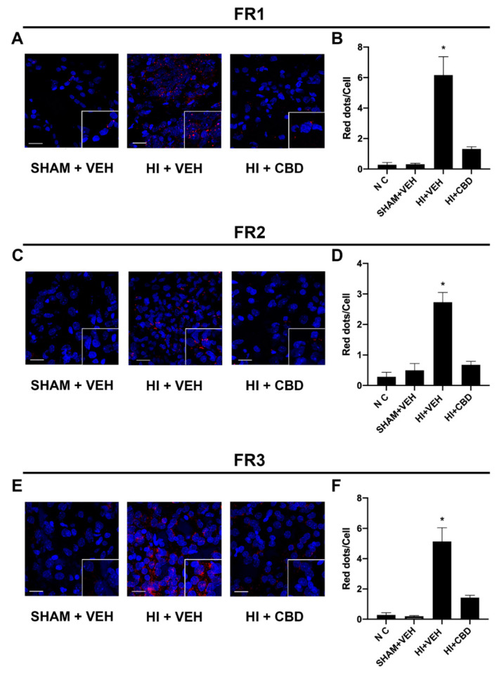 CB2-5HT1A heteromer expression in brain slices from hypoxia-induced Wistar rats. (A,C,E) CB2–5HT1A-Hets expression in brain slices from hypoxia-induced Wistar rats (HI + VEH), hypoxia-induced Wistar rats treated with CBD (HI + CBD), and control Wistar rats (SHAM + VEH), detected by PLA. Rat brains were dissected 1 (FR3), 7 (FR2), or 30 (FR1) days after the insult, as described in the Materials and Methods. Red dots indicate expression of heteromers. Hoechst-stained nuclei appear in blue. (B,D,F) Quantification of the CB2–5HT1AHets was conducted by detecting the number of red dots/cell using the Andy’s algorithm Fiji’s plug-in. Samples from 6 different animals were processed and analyzed. The NC negative control bar in panels B, D, and F refers to counts in cells treated only with secondary antibodies. Scale bar: 20 μm. * p < 0.05 versus SHAM+VEH.