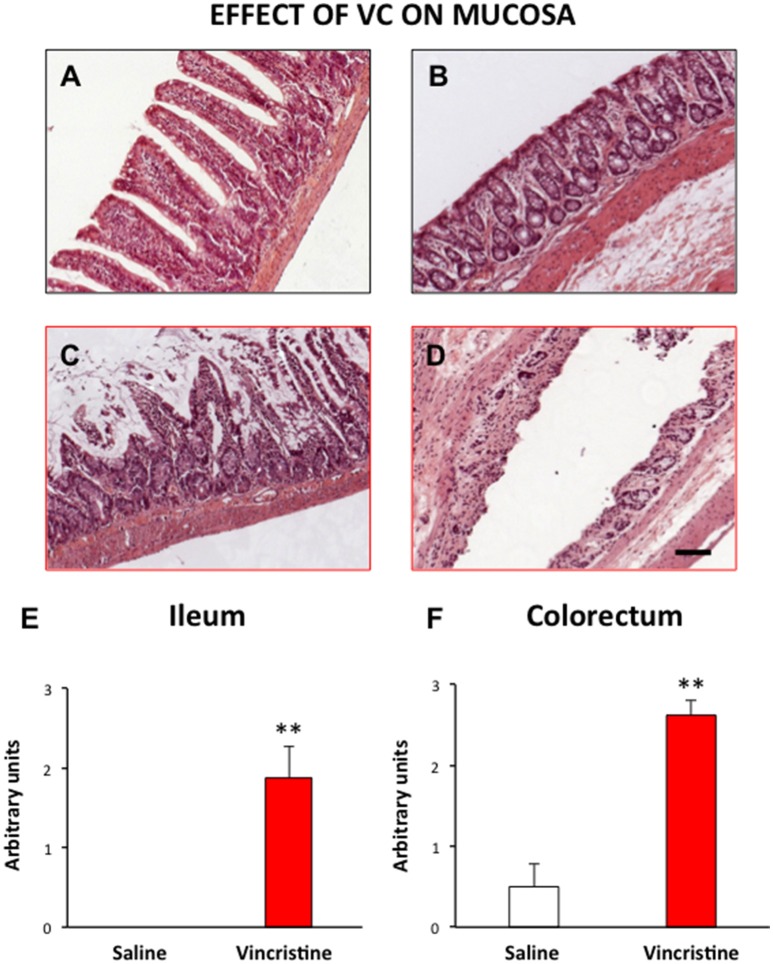 Effect of vincristine treatment on the general structure of the rat intestine. Rats were injected intraperitoneally with vincristine (0.5 mg/kg) or saline (1–2 ml/kg). Forty-eight hours after treatment, histological samples were embedded in paraffin, and stained with HE. Left row, small intestine: tissue samples from saline (A) and vincristine-treated animals (C) showing the damaged mucosa; quantitative analysis of the histological damage (E). Right row, colorectum: tissue samples from saline (B) and vincristine-treated animals (D) showing the damaged mucosa; quantitative analysis of the histological damage (F). Bars show mean values ± SEM for control (white) and vincristine-treated animals (red). Each group consisted of 4–8 rats. **p < 0.01 vs. saline; (Student's t-test). Scale bar: 100 μm.