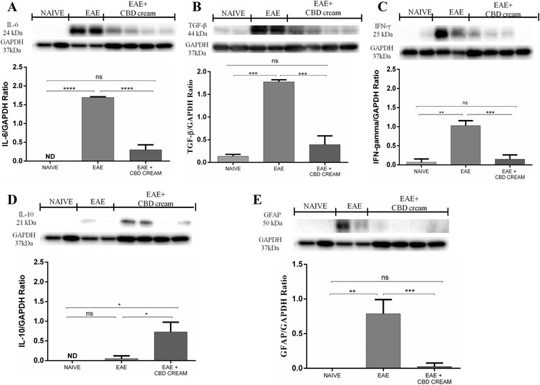Western blot analysis for IL-6 was showed in a. ****p < 0.0001 vs EAE, ****p < 0.0001 vs EAE + 1 % CBD-cream. Western blot analysis for TGF-β (b). ***p < 0.0004 vs EAE, ***p < 0.0004 vs EAE + 1 % CBD-cream. In c was displayed western blot analysis for IFN-γ. **p < 0.0011 vs EAE, ***p < 0.0008 vs EAE + 1 % CBD-cream. Western blot analysis for IL-10 (d). *p < 0.0326, *p < 0.0415 vs EAE + 1 % CBD-cream. In e was displayed western blot analysis for GFAP **p < 0.0016 vs EAE, ***p < 0.0009 vs EAE + 1 % CBD-cream. ND not detectable