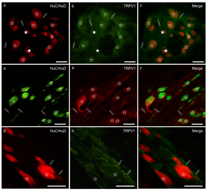 TRPV1 immunoreactivity in the myenteric plexus of the pig ileum: (a) HuC/HuD immunoreactive neurons, (b) TRPV1 immunoreactivity, (c) merge image. The open stars indicate the HuC/HuD immunoreactive neurons co-expressing moderate TRPV1 immunoreactivity. The white stars indicate HuC/HuD immunoreactive neurons, which were TRPV1 negative. The arrows indicate the TRPV1 immunoreactive varicosities encircling the neuronal cell bodies. (d) HuC/HuD immunoreactive neurons, (e) TRPV1 immunoreactivity, (f) merge image. The stars indicate the HuC/HuD immunoreactive neurons co-expressing moderate-to-bright TRPV1 immunoreactivity. The arrows indicate TRPV1 immunoreactive neuronal processes. (g) HuC/HuD immunoreactive neurons, (h) TRPV1 immunoreactivity, (i) merge image. The stars indicate two HuC/HuD immunoreactive myenteric plexus neurons co-expressing weak and diffuse TRPV1 immunoreactivity; the arrows indicate two perineuronal enteric glial cells expressing bright TRPV1 immunoreactivity. Scale bar: 50 µm.