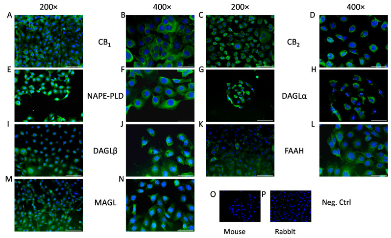 Human corneal epithelial cells express endocannabinoid receptors and endocannabinoid metabolizing enzymes in vitro: (A,B) CB1-specific, (C,D) CB2-specific, (E,F) NAPE-PLD-specific, (G,H) DAGLα-specific, (I,J) DAGLβ-specific, (K,L) FAAH-specific, and (M,N) MAGL-specific immunoreactivity, as shown by immunofluorescence (green fluorescence) on human corneal epithelial cell cultures. Nuclei were counterstained with DAPI (4′,6-diamidino-2-phenylindole; blue fluorescence). (O) Negative control of panels C, D, G–N; (P) negative control of panels A, B, E, and F. Scale bars mark 100 μm or 50 μm, depending on magnification (200× and 400×, respectively).