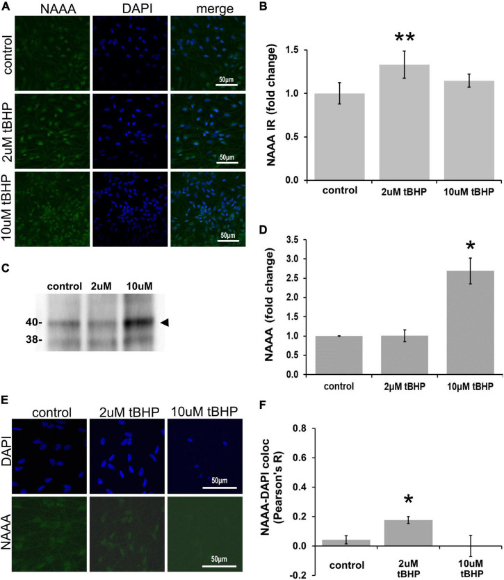 Expression of N-acylethanolamine acid amidase (NAAA) in ReN cells under conditions of oxidative stress. (A) ReN cells express NAAA in the soma, including in the nuclear envelop and possibly in the nucleus, as well as neurites. (B) Exposure of ReN cells to sublethal concentration of tert-butylhydroperoxide (tBHP) resulted in a biphasic NAAA expression pattern–2 μM tbHP led to a 35% increase in NAAA immunoreactivity while 10 μM did not, although a trend toward an increase existed. Green fluorescence is NAAA and blue fluorescence is DAPI. (C,D) Western blot analysis reveals that the expression of a 40-kDa band (expected molecular weight is 40 kDa) corresponding to NAAA is upregulated 2.6-fold by exposure to 10 μM tBHP by. (E,F) Colocalization analysis between NAAA immunoreactivity with DAPI fluorescence (DNA) reveals no significant colocalization at resting untreated conditions, but 2 μM tBHP exposure led to a slight increase in Pearson’s R (from 0.03 to 0.20). Higher tBHP concentrations (10 μM) had no effect on NAAA-DAPI colocalization. *p ≤ 0.05, **p ≤ 0.01.