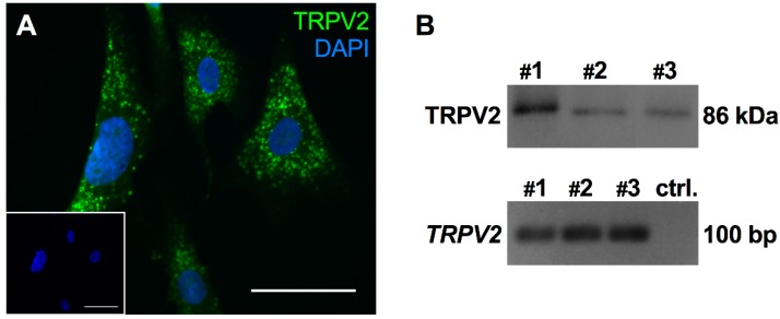 TRPV2 expression was confirmed in cultured HTPCs. (A) On the cellular level, TRPV2 exhibited a scattered expression pattern. Scale bar 10 µm. (B) In cultured HTPCs, expression of TRPV2 was detected by Western blot with a single band of the expected size (86 kDa) and RT-PCR showed clear bands at ~100 bp. Sequencing of the PCR-product validated expression of TRPV2. Bands obtained from three individual patients (#1–3) and negative control without cDNA in the RT-PCR reaction (ctrl.).