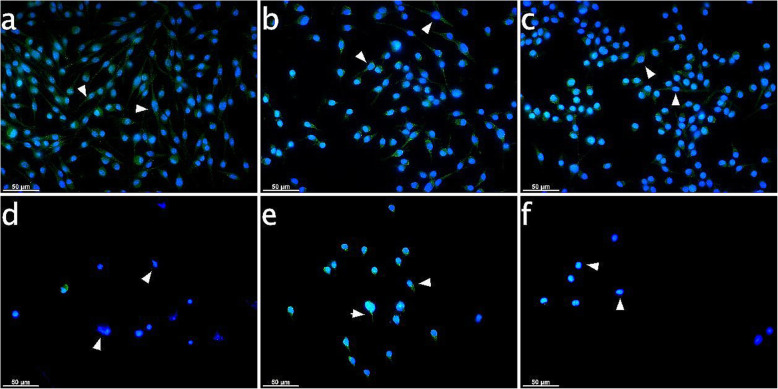 IBA-1 expression in microglia subject to CB receptor agonist modulation with or without CII for 10 h. Immunocytochemical analyses for IBA-1 (green) after 10 h stimulation in cultured Embryonic stem cell-derived microglia (ESdM) cells. The IBA-1 signals were distributed equally in the cytoplasm for controls and with endocannabinoid treatment (arrowheads on Fig. a, b, c). CII effected loss of cells. IBA-1 signal diminished upon CII treatment (arrowheads on Fig. d showing cell bodies without fluorescence signal in the cytoplasm). CII plus PEA treatment lead to translocation of IBA-1 signal into the nuclei (arrowheads on Fig. f). IBA-1 signal resembled control cells in the CII specimes additionally exposed to AEA (arrowheads on Fig. e). a: Control, b: AEA-treated (50 μM), c: PEA-treated (50 μM), d: 6 h CII, e: 6 h CII plus AEA-treated (50 μM), f: 6 h CII plus PEA-treated (50 μM). Visualization was performed with Alexa 488 (green) secondary antibody. Nuclei were stained with DAPI (blue). Scale bar is 50 μm