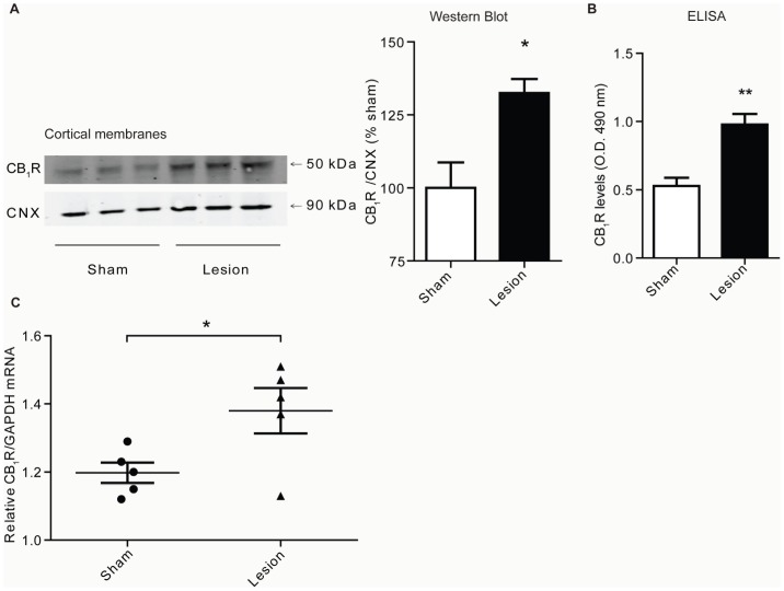 CB1R levels increase in cortex of lesioned animals. A, Representative Western Blot and quantification for CB1R and CNX (Calnexin) in cortical membranes from 3 individual sham or lesioned animals, 14 days after surgery. Data represent Mean ± SEM (n = 6 animals/group). B, ELISA data for CB1R detection using a CB1R specific antibody in cortical membranes from sham and lesioned animals 14 days after surgery. Data represent Mean ± SEM (n = 4 animals/group). Statistically significant differences between sham and lesion groups are indicated*, p<0.05; **, p<0.01 (t-test). C, RT-PCR for CB1R (measured relative to GAPDH) in cortical preparations from sham and lesioned animals 14 days after surgery. Data represent Mean ± SEM (n = 5 animals/group). Statistically significant differences between sham and lesion groups are indicated *, p<0.05 (t-test).