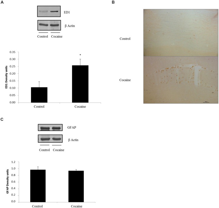 ED1 (68 kDa) and β-Actin (42 kDa) western blot dots in rat cerebellum. Representation of ED1 (density units) in cerebellum showing a significant ED1 increase in cerebellar samples of cocaine-treated rats (*p < 0.05 vs. control group; A). ED1 immunohistochemistry from control and cocaine-treated cerebellar samples. Little or null ED1 positive cells can be observed in control samples, whereas noticeable ED1 positive cells can be found around cerebellar vessels (B). GFAP (50 kDa) and β-Actin (42 kDa) western blot dots in control and cocaine-treated cerebellar samples, with GFAP representation (as density units). No differences can be set between control and cocaine-treated rats suggesting a lack of astrocytic response after cocaine exposure (C).