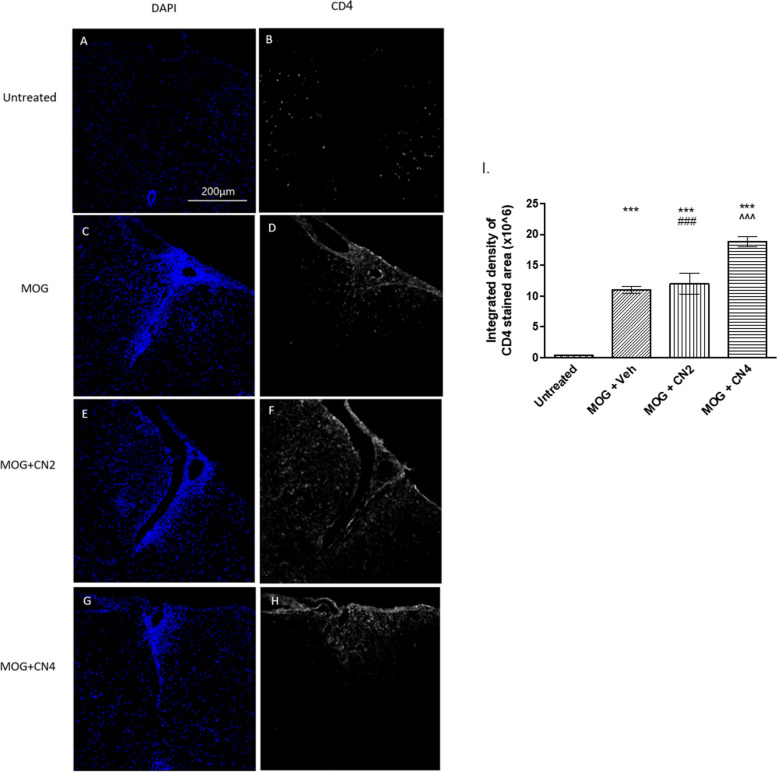 Infiltration of CD4+ T cells into the spinal cord of cannabis-treated mice. MOG35-55-given female C57BL/6 mice were treated with vehicle, CN2, or CN4. Spinal cords were removed and cut horizontally. Sections were stained using antibodies against CD4+ T cells (gray), and the cell nuclei were stained with DAPI (blue) and examined using a confocal microscope (X20 magnification). The images (A-H) are representative images of 2 independent experiments, with 5 mice in each group. In I, the graphical result is presented as the mean ±SEM of the color intensity to the area, n ≥10. *** - p <0.001 vs. control, ^^^p <0.001 vs. MOG, ### p <0.001 vs. CN4