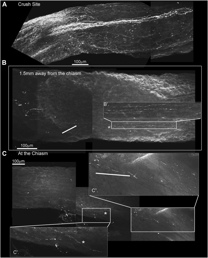 GAP-43 immunostaining using the iDISCO method to stain and chemically clear the entire optic nerve that was crushed and 4-drug treated reveals GAP-43 staining in the chiasm. ONC with 4-drug treatment and i-DISCO GAP-43 staining reveals the crush site with regenerating fibers (A). Approximately 6 mms away from the crush, near the chiasm we also detect GAP-43 positive axons (B) the blowup displays several of these GAP-43+ axons. We even detect fibers in the chiasm (C) as revealed by the blowups in C’ and C”.