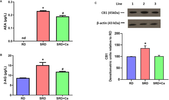 Three-panel scientific figure. Panel A: Bar graph comparing AEA levels in RD, SRD, and SRD+Ca groups, showing significant increase in SRD and reduced level in SRD+Ca. Panel B: Bar graph for 2-AG levels, significantly higher in SRD and intermediate in SRD+Ca compared to RD. Panel C: Western blot images for CB1 (45 kDa) and β-actin (43 kDa), with densitometric bar graph showing increased CB1 expression in SRD and partial reduction in SRD+Ca relative to RD. Statistical symbols denote significant group differences.