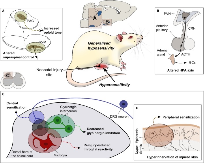 Potential mechanisms underlying the long-term effects of neonatal injury in adulthood. Changes to (A) brainstem descending pain control and (B) the HPA axis are hypothesized to underlie generalized baseline hyposensitivity whereas changes to (C) dorsal horn circuits and microglial reactivity and (D) peripheral terminals are hypothesized to underlie hypersensitivity in the region in and around the neonatal injury. See text for further details.