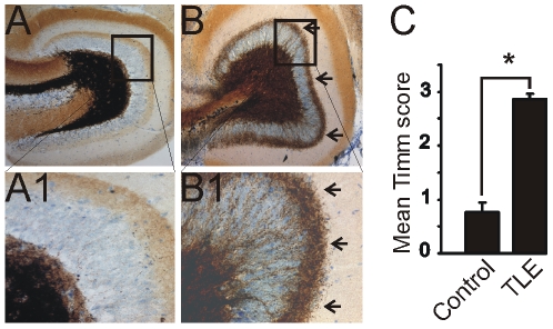 Timm stain illustrating mossy fiber sprouting into the dentate gyrus inner molecular layer in pilocarpine-treated mice. A. Dentate gyrus of a normal mouse. B. Dentate gyrus of a pilocarpine-treated mouse that survived status epilepticus (SE) showing mossy fiber sprouting. A1 and B1 are enlarged boxed regions of A and B. The arrows in B and B1 point to extensive mossy fiber sprouting into the inner molecular layer of the dentate gyrus. C. Graph showing the mean Timm score between controls and pilocarpine-treated mice that survived SE. Asterisk, significant difference between mean scores (P<0.05).