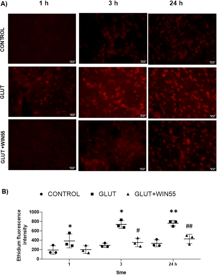 Reactive oxygen species (ROS) production in WT mice after glutamate (GLUT) intracerebral injection treated with or without WIN55, at 1, 3, and 24 h. (A) Representative microphotographs of DHE staining of the striatum (n = 3). The scale bar represents 50 μm. (B) Quantification of Ethidium fluorescence intensity in the different groups. Results are means ± standard deviation. *p < 0.05, **p < 0.01, versus the corresponding control; #p < 0.05, ##p < 0.01 versus the corresponding mice treated with glutamate (GLUT).