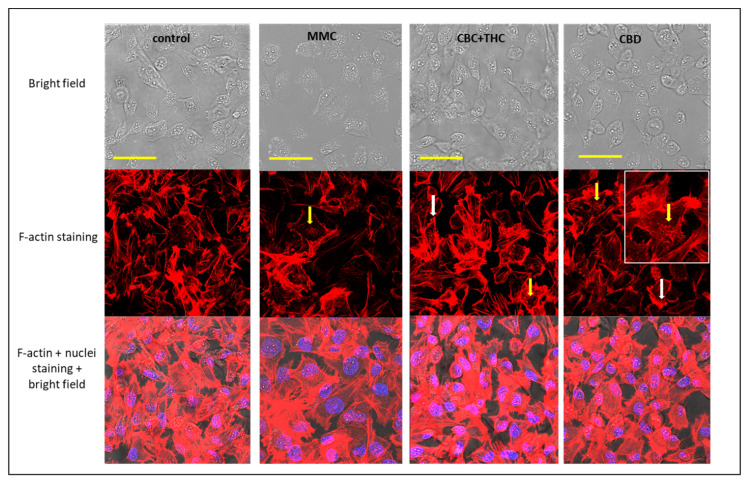 Confocal images of T24 cells following treatment with methanol (the vehicle control), Mitomycin-C (MMC, 4 µg/mL) as positive control, CBC + THC (8.6 + 1.4 µg/mL, respectively) and CBD (10 µg/mL) on T24 cell line for 24 h. F-actin (EasyProbes™ ActinRed 555 Stain, red stain), and nuclei (Hoechst, blue stain) were stained. Bars = 50 µm; yellow arrows point to disintegration of F-actin filaments visualized as characteristic spots; white arrows point to induced accumulation of F-actin filaments on the cell periphery.
