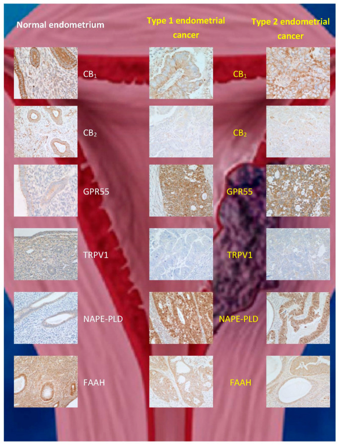 Immunohistochemical staining patterns for ECS proteins in normal endometrium and (type 1 and type 2) endometrial cancer. The data are taken from [74], where validation for the commercial antibodies and techniques used can be found. Note the reduction in CB1, CB2, TRPV1, and FAAH protein staining and increases for GPR55 and N-acylphosphatidylethanolamine-specific phospholipase D (NAPE-PLD) expression in both types of endometrial cancer when compared to that of normal tissue.