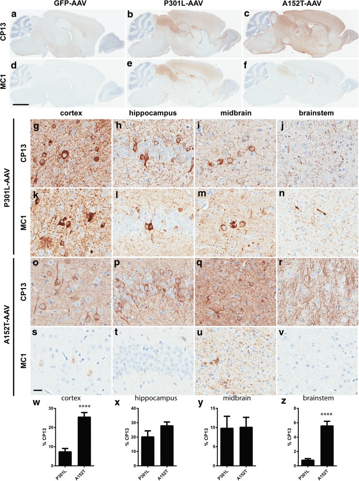 Striking differences in the pattern of tau accumulation in P301L and A152T-expressing animals. a-f Representative low-power images comparing the distribution and intensity of CP13 and MC1 immunoreactivity in GFP-AAV (a and d), TauP301L-AAV (b and e), and TauA152T-AAV mice (c and f). g-v High-power images revealing differences in the deposition of CP13 and MC1-positive tau species between TauP301L-AAV (g-n) and TauA152T-AAV (o-v) mice in the cortex (g, k, o and s), hippocampus (h, l, p and t), midbrain (i, m, q and u) and brainstem (j, n, r and v). w Quantitative analysis of CP13 immunoreactivity was performed in cortex (t = 6.64, p < 0.0001); x hippocampus (t = 1.6, p = 0.12); y midbrain (t = 0.07, p = 0.95); and z brainstem (t = 7.36, p < 0.0001). Scale bar in (a-f) equals 2 mm; scale bar in (g-v) equals 20 μm. ****p < 0.0001