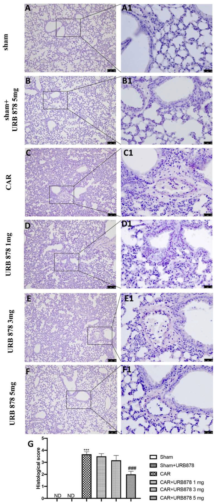 Inhibitions of CAR-induced lung injury by URB878. Sham (A,A1); Sham+URB878 5 mg/kg (B,B1); CAR (C,C1); CAR+URB878 1 mg/kg (D,D1); CAR+URB878 3 mg/kg (E,E1); CAR+URB878 5 mg/kg (F,F1); Histological score (G). ND: not detectable. Scale bar for (A–F) was 100 μm; Scale bar for (A1–F1) was 25 μm; Values are means ± SEM of 6 mice for all groups. Photos shown are representative of the results obtained. See manuscript for further details. *** p < 0.001 vs. sham; ### p < 0.001 vs. CAR.